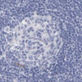 Anti-APOH antibody produced in rabbit Prestige Antibodies&#174; Powered by Atlas Antibodies, affinity isolated antibody, buffered aqueous glycerol solution