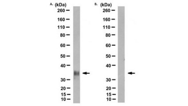 Anti-Prion Protein Antibody, clone POM2 clone POM2, from mouse