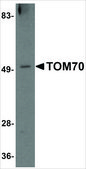 Anti-TOM70 antibody produced in rabbit affinity isolated antibody, buffered aqueous solution