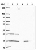 Anti-RALA antibody produced in rabbit Prestige Antibodies&#174; Powered by Atlas Antibodies, affinity isolated antibody, buffered aqueous glycerol solution