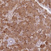 Anti-CLPS antibody produced in rabbit Prestige Antibodies&#174; Powered by Atlas Antibodies, affinity isolated antibody, buffered aqueous glycerol solution