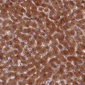 Anti-SULT2A1 antibody produced in rabbit Prestige Antibodies&#174; Powered by Atlas Antibodies, affinity isolated antibody, buffered aqueous glycerol solution