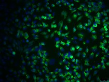 SCp2 Mouse Mammary Epithelial Cell Line