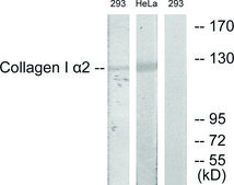 Anti-Collagen I &#945;2 antibody produced in rabbit affinity isolated antibody