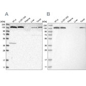 Anti-PFAS antibody produced in rabbit Prestige Antibodies&#174; Powered by Atlas Antibodies, affinity isolated antibody, buffered aqueous glycerol solution, Ab2
