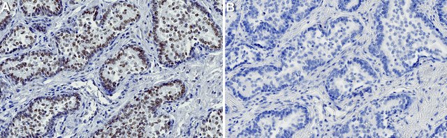 Anti-RAD50 Antibody, clone 1I11 ZooMAb&#174; Rabbit Monoclonal recombinant, expressed in HEK 293 cells