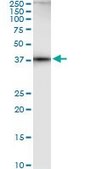 ANTI-AHCY antibody produced in mouse clone M2, purified immunoglobulin, buffered aqueous solution