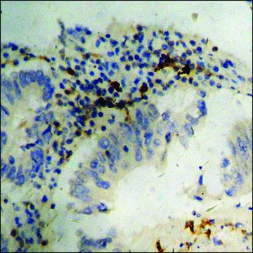 Anti-phospho-Retinoblastoma (pSer811) antibody produced in rabbit affinity isolated antibody