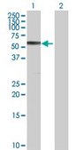 Anti-CBS antibody produced in rabbit purified immunoglobulin, buffered aqueous solution