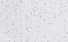 Anti-Prion Protein Antibody, clone 3F17 ZooMAb® Rabbit Monoclonal recombinant, expressed in HEK 293 cells