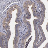 Anti-ESYT2 antibody produced in rabbit Prestige Antibodies&#174; Powered by Atlas Antibodies, affinity isolated antibody, buffered aqueous glycerol solution