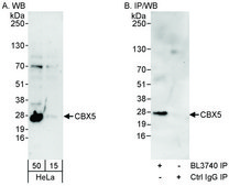 Rabbit anti-CBX5 Antibody, Affinity Purified Powered by Bethyl Laboratories, Inc.