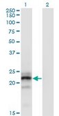 Monoclonal Anti-CGB, (C-terminal) antibody produced in mouse clone 3B4, purified immunoglobulin, buffered aqueous solution