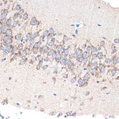 Anti-PAK3 antibody produced in rabbit