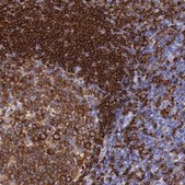 Anti-BTK antibody produced in rabbit Ab1, Prestige Antibodies&#174; Powered by Atlas Antibodies, affinity isolated antibody, buffered aqueous glycerol solution