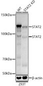 [KO Validated]Anti-STAT2 Antibody, clone 4A5P8, Rabbit Monoclonal