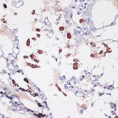 Anti-CD68 antibody produced in rabbit