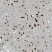 Monoclonal Anti-MEF2C antibody produced in mouse Prestige Antibodies&#174; Powered by Atlas Antibodies, clone CL0368, purified immunoglobulin, buffered aqueous glycerol solution