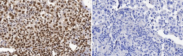 Anti-RPA1 Antibody, clone 1J5 ZooMAb&#174; Rabbit Monoclonal recombinant, expressed in HEK 293 cells