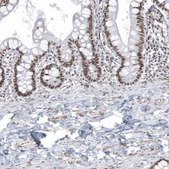 Anti-KMT5C antibody produced in rabbit Prestige Antibodies&#174; Powered by Atlas Antibodies, affinity isolated antibody, buffered aqueous glycerol solution