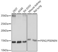 Anti-PEN2/PSENEN Antibody, clone 6J5O4, Rabbit Monoclonal