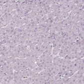 Anti-CAMK2A antibody produced in rabbit Prestige Antibodies® Powered by Atlas Antibodies, affinity isolated antibody, buffered aqueous glycerol solution