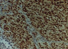 Anti-MGMT Antibody, clone MT3.1 clone MT3.1, Chemicon&#174;, from mouse
