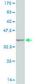Monoclonal Anti-RET antibody produced in mouse clone 1A5, purified immunoglobulin, buffered aqueous solution