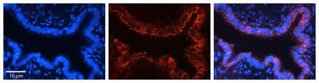 Anti-VDAC2 antibody produced in rabbit affinity isolated antibody