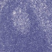 Anti-TGM4 antibody produced in rabbit Prestige Antibodies&#174; Powered by Atlas Antibodies, affinity isolated antibody, buffered aqueous glycerol solution