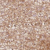 Anti-KCNQ1 antibody produced in rabbit Prestige Antibodies&#174; Powered by Atlas Antibodies, affinity isolated antibody, buffered aqueous glycerol solution