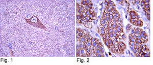 Anti-TrkA Antibody Upstate&#174;, from rabbit