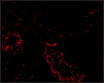 Anti-ACE2 antibody produced in rabbit affinity isolated antibody, buffered aqueous solution