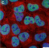 Anti-phospho-c-Fos (Ser32) Antibody, clone 2F15 ZooMAb&#174; Rabbit Monoclonal recombinant, expressed in HEK 293 cells