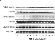 Anti-Active-&#946;-Catenin (Anti-ABC) Antibody, clone 8E7 clone 8E7, Upstate&#174;, from mouse