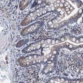 Anti-C20orf196 antibody produced in rabbit Prestige Antibodies&#174; Powered by Atlas Antibodies, affinity isolated antibody, buffered aqueous glycerol solution