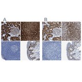 Anti-ASS1 antibody produced in rabbit Prestige Antibodies&#174; Powered by Atlas Antibodies, affinity isolated antibody, buffered aqueous glycerol solution, Ab1