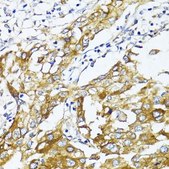 Anti-GLUT4 antibody produced in rabbit