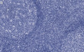 Anti-Syk Antibody, clone 2G22 ZooMAb&#174; Rabbit Monoclonal recombinant, expressed in HEK 293 cells