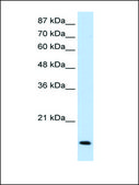 Anti-MyC antibody produced in rabbit IgG fraction of antiserum