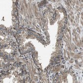 Anti-SEC62 antibody produced in rabbit Prestige Antibodies&#174; Powered by Atlas Antibodies, affinity isolated antibody, buffered aqueous glycerol solution
