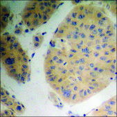 Anti-phospho-PP2A-&#945; (pTyr307) antibody produced in rabbit affinity isolated antibody