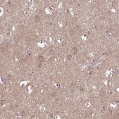 Anti-TLN2 Prestige Antibodies&#174; Powered by Atlas Antibodies, affinity isolated antibody