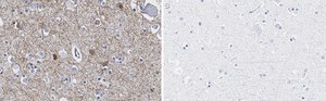 Anti-GAD65 Antibody, clone 3B23 ZooMAb&#174; Rabbit Monoclonal recombinant, expressed in HEK 293 cells