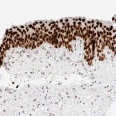 Anti-RCC1 antibody produced in rabbit Prestige Antibodies&#174; Powered by Atlas Antibodies, affinity isolated antibody, buffered aqueous glycerol solution, ab1