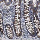 Anti-VPS13A antibody produced in rabbit Prestige Antibodies&#174; Powered by Atlas Antibodies, affinity isolated antibody, buffered aqueous glycerol solution, Ab1