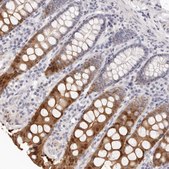Anti-FABP1 antibody produced in rabbit Prestige Antibodies&#174; Powered by Atlas Antibodies, affinity isolated antibody, buffered aqueous glycerol solution