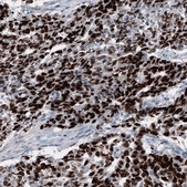Monoclonal Anti-SALL4 antibody produced in mouse Prestige Antibodies® Powered by Atlas Antibodies, clone CL12180, purified immunoglobulin, buffered aqueous glycerol solution
