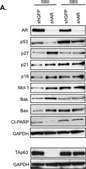 Anti-Bak Antibody, NT Upstate&#174;, from rabbit