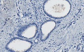 Anti-CXADR/CAR Antibody, clone 1D19 ZooMAb® Rabbit Monoclonal recombinant, expressed in HEK 293 cells